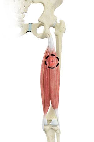knee condition 