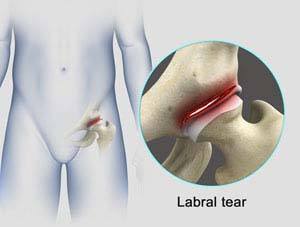 knee condition 