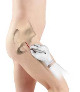 knee condition