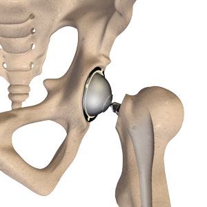 knee condition