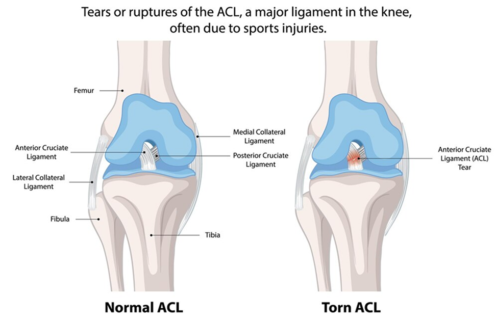 knee condition 
